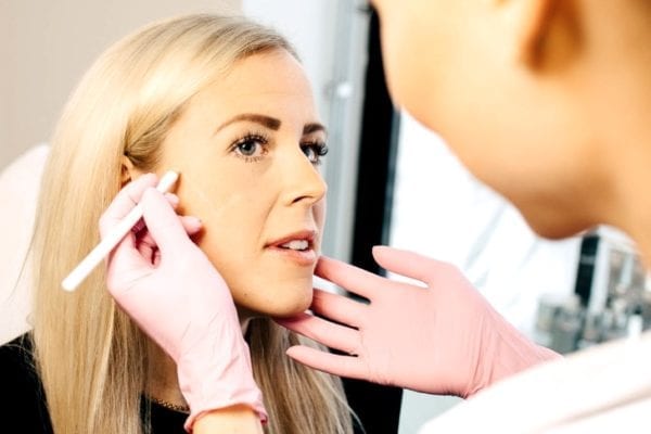Hårtransplantation med FUE-penna på kvinde med lyseblondt hår