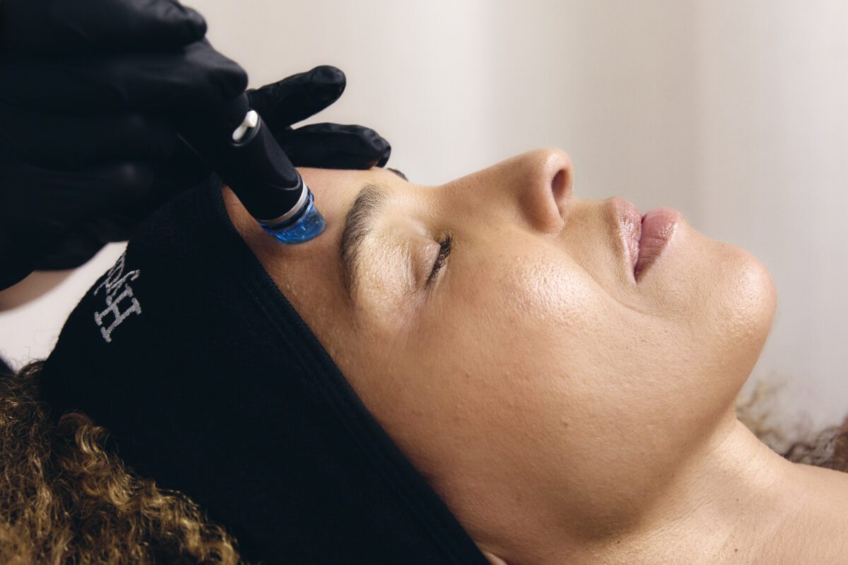 Kvinde modtager HydraFacial-behandling med blå håndholdt applikator