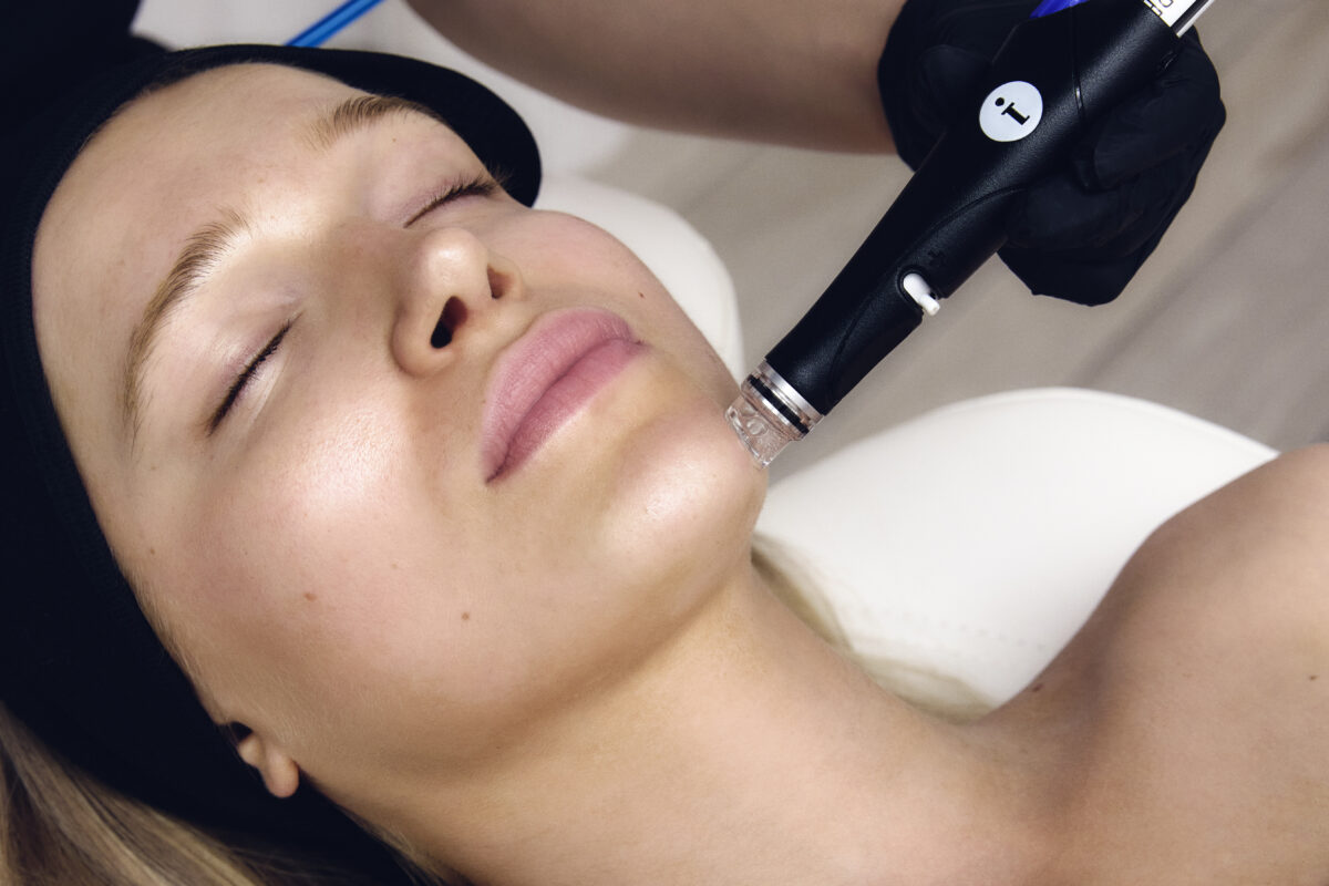 Kvinde får HydraFacial-behandling med håndholdt applikator på kinden