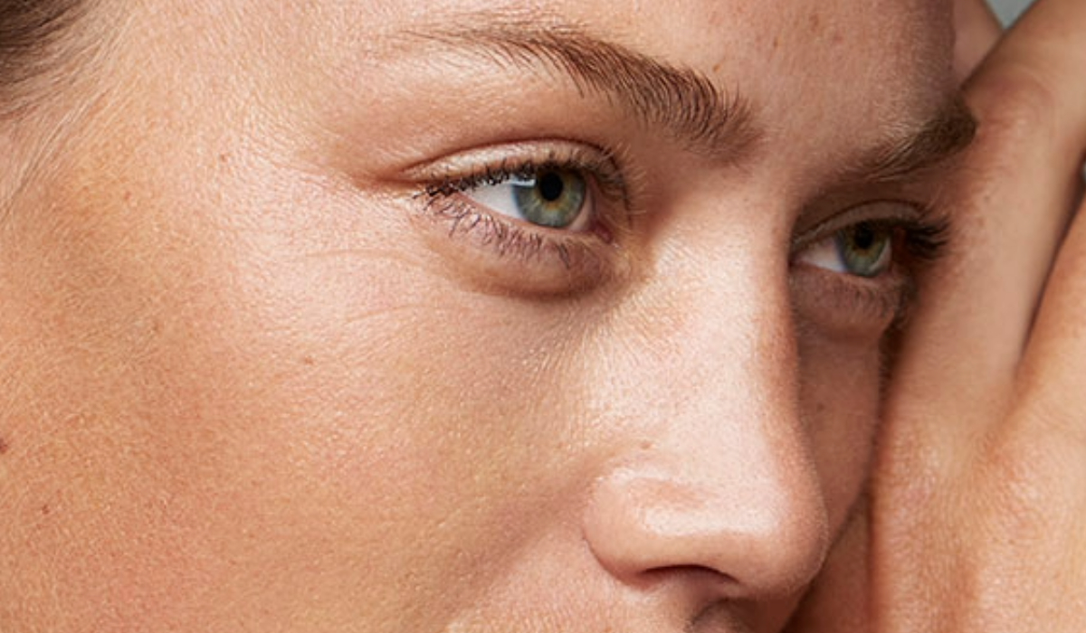 Blepharoplasty