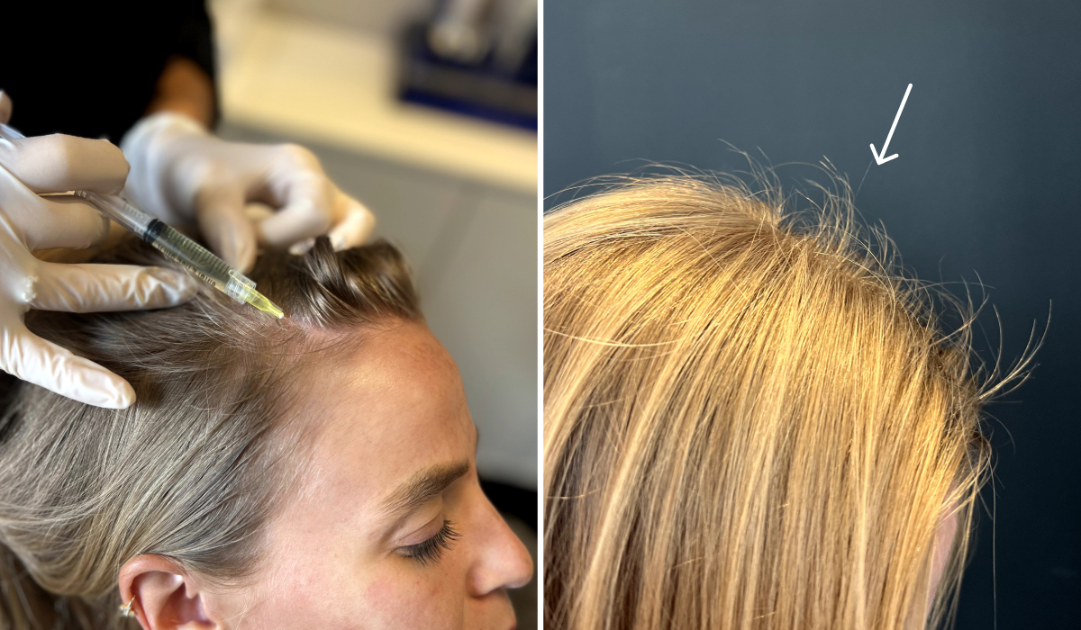 cellbooster hair