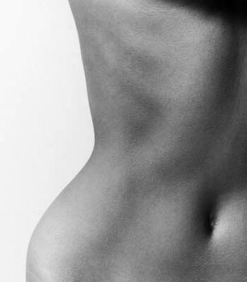 Kvinde torso efter bodylift i sort-hvid profil