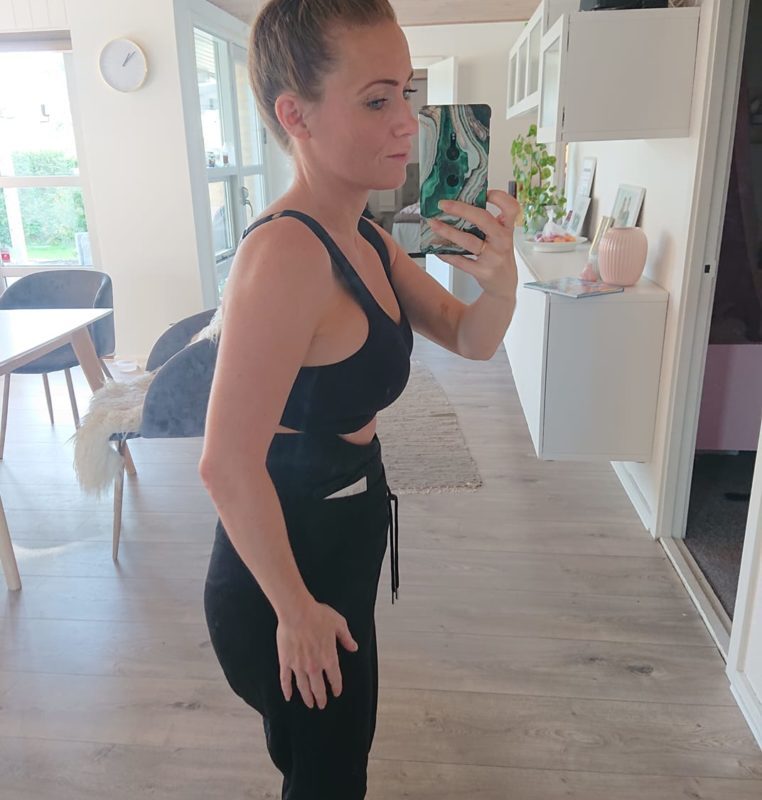mommy makeover