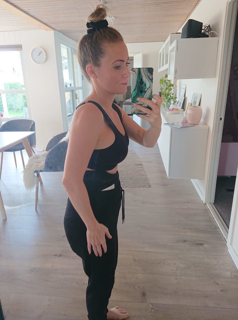 mommy makeover