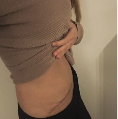 majse wirghtloss makeover