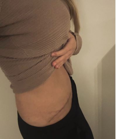 majse wirghtloss makeover