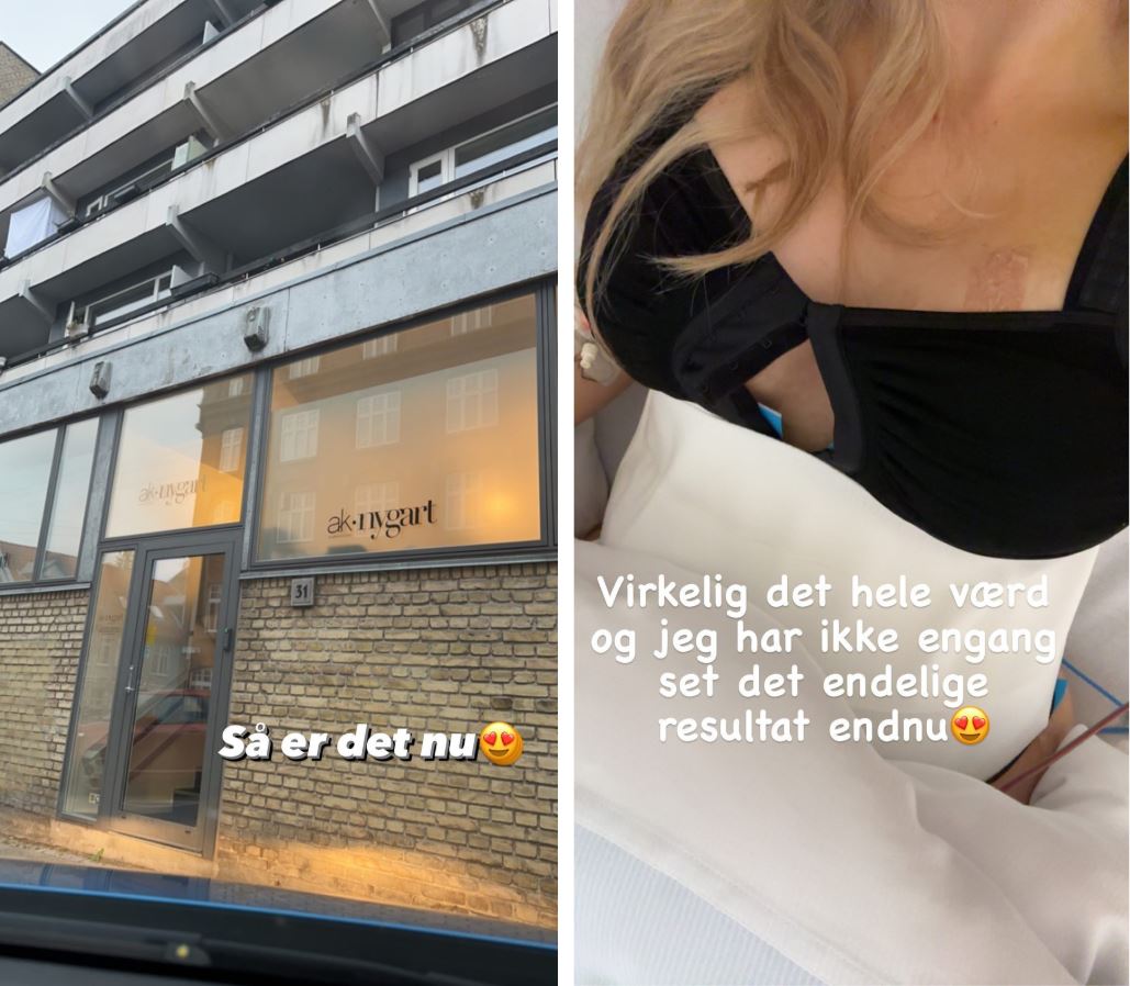 majse maveoperation