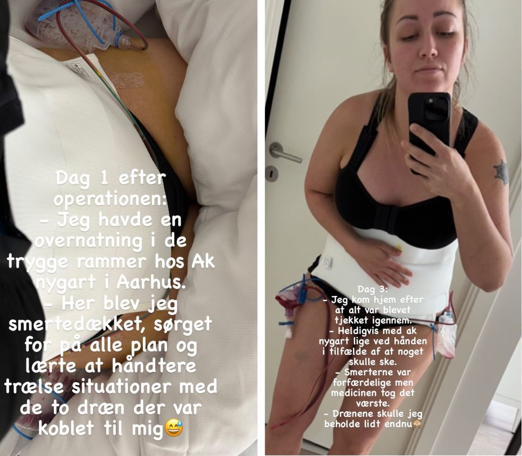 majse operation