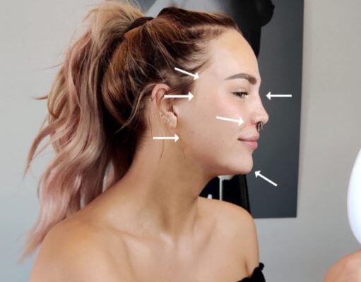 feminin med filler