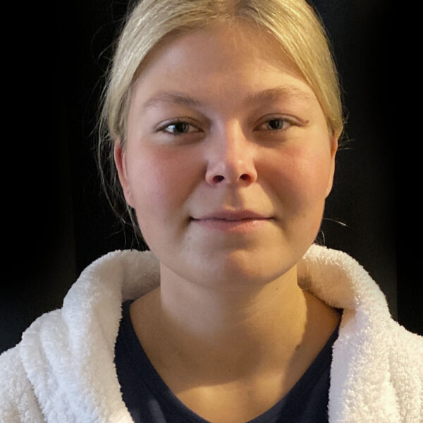 Fedtsugning af øvre del af hals - Før